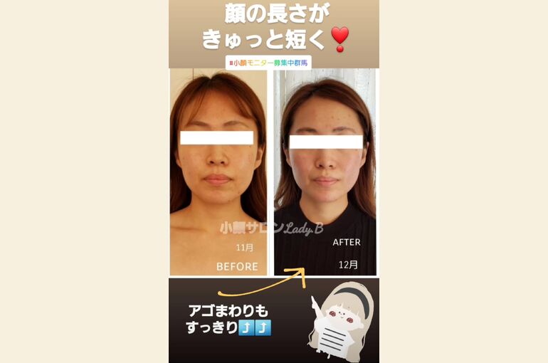 Screenshot_20221026-150215_Instagram