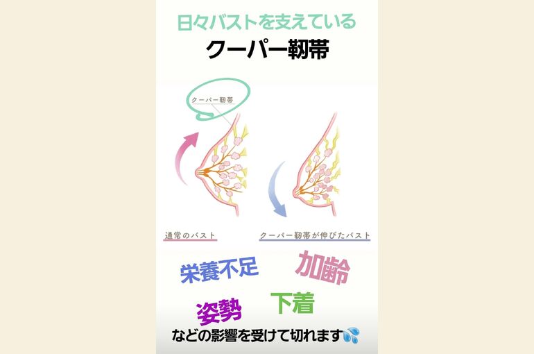 Screenshot_20230222-131545_Instagram