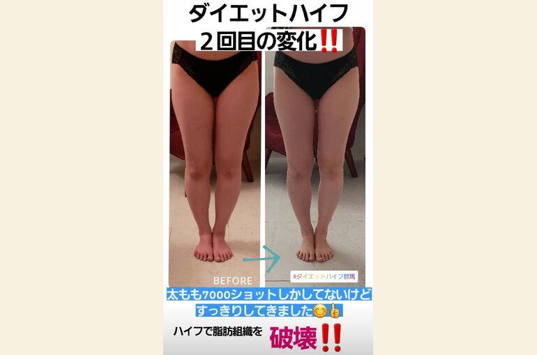 Screenshot_20220206-162610_Instagram